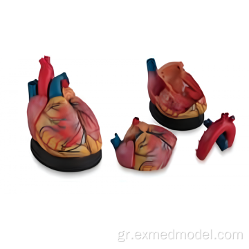 Διευρυμένο μοντέλο ανατομίας καρδιάς